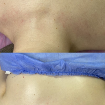 Катерина Сіліна, Миколаїв Фото - 6