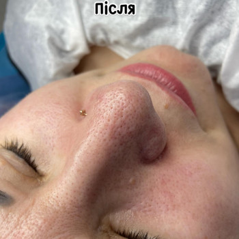 Катерина Сіліна, Миколаїв Фото - 10