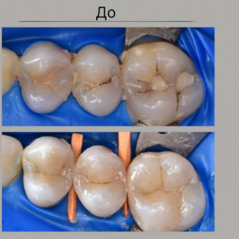 DentTim, Новомосковск Фото - 5