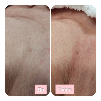 Олена Гевко, Київ Фото - 6