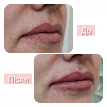 Олена Гевко, Київ Фото - 9