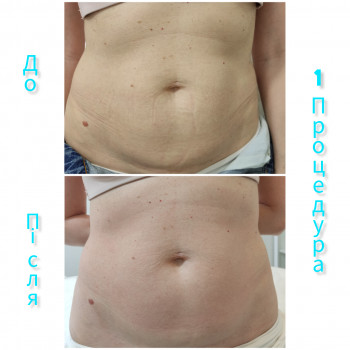 Олена Гевко, Київ Фото - 10