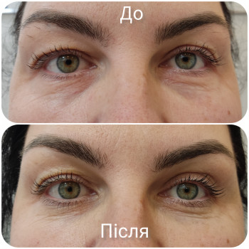 Олена Гевко, Київ Фото - 11