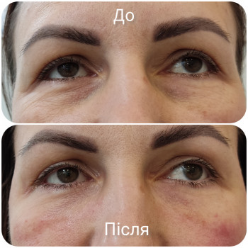 Олена Гевко, Київ Фото - 12