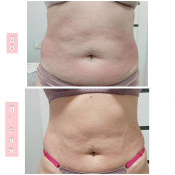 Олена Гевко, Київ Фото - 13