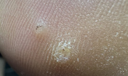  Подолог Виктория Борисполь