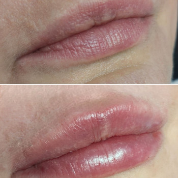 Контурна пластика губ
                    Студия татуажа Майстерня перманентного макіяжу Олени Олійник Львов