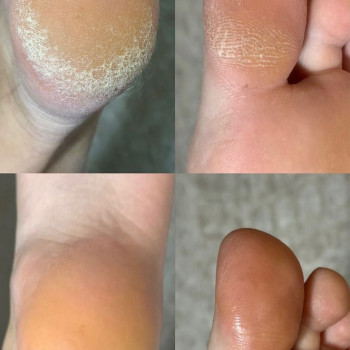 Анастасія Коломоєць, Полтава Фото - 9