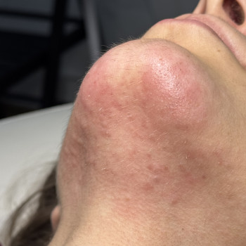 Працює навіть на обличчі