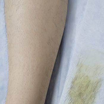 Одразу різниця помітна)