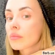 Тритментолог Алина Бубновская на Barb.ua