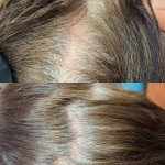 Гідро SPA терапія для волосся Дерматолог косметолог Нелли Киев