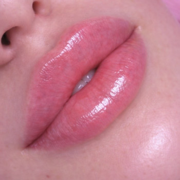 фотосесія косметолог, збільшення губ, контурна пластика губ