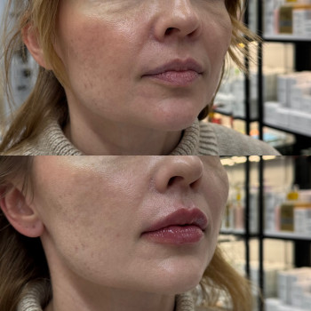 Косметологія doctor Khaneichuk, Луцьк Фото - 5