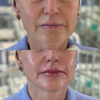 RRS Long Lasting
                    Косметологический центр  Луцк