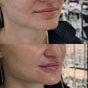 RRS Long Lasting
                    Косметологический центр  Луцк