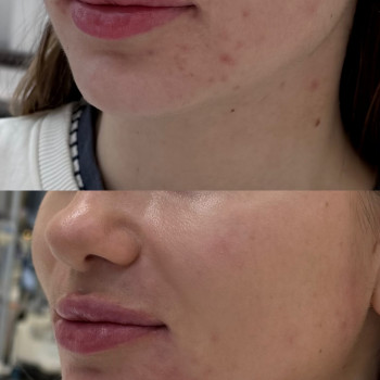 RRS Long Lasting
                    Косметологический центр  Луцк