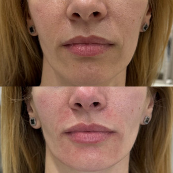 RRS Long Lasting
                    Косметологический центр  Луцк