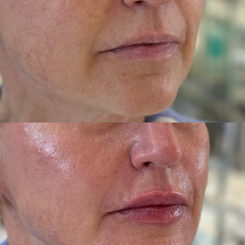 RRS Long Lasting
                    Косметологический центр  Луцк