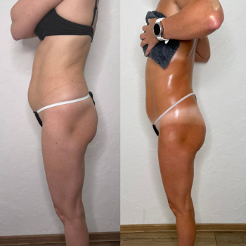 Татьяна Кузьменко, Кропивницкий Фото - 4