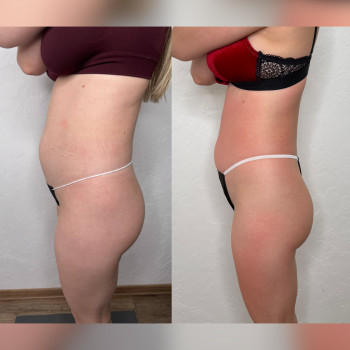 Татьяна Кузьменко, Кропивницкий Фото - 5