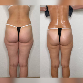 Татьяна Кузьменко, Кропивницкий Фото - 6