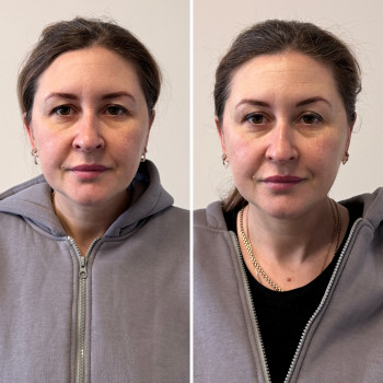 Юлія Заворицька, Бровари Фото - 15