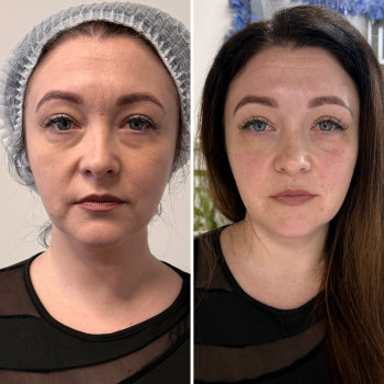 Юлія Заворицька, Бровари Фото - 2