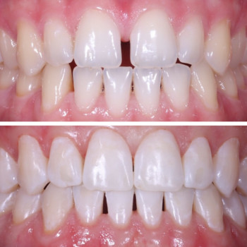 Фото из портфолио клиники Перлина  (стоматологическая клиника, Тернополь)