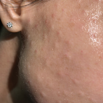 Ірина Акуленко, Киев Фото - 61