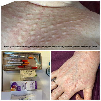 Біоревіталізація