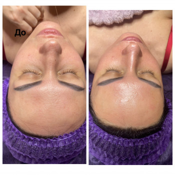 Ніна Олефіренко, Миколаїв Фото - 7