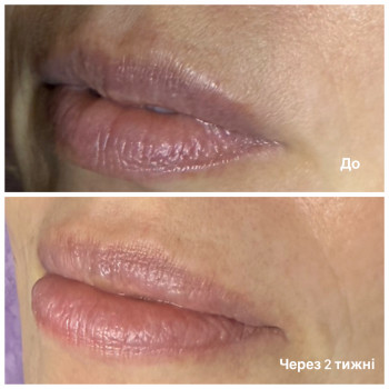 Ніна Олефіренко, Миколаїв Фото - 10