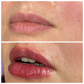 Ніна Олефіренко, Миколаїв Фото - 21