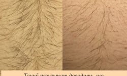  Мастер шугаринга Яна Полтава