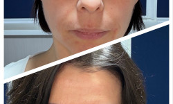 Экспресс-восстановление кожи лица Косметолог Полина Черкаси