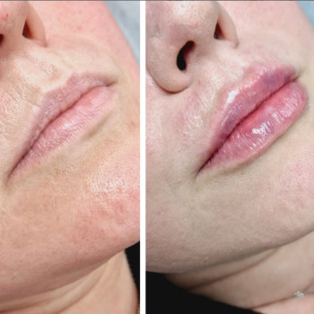 Інна Вороніна, Кам'янське Фото - 5