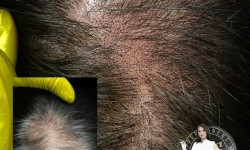 Перманентная трихопигментация (SMP) Майстер перманентного макіяжу Марта Львів