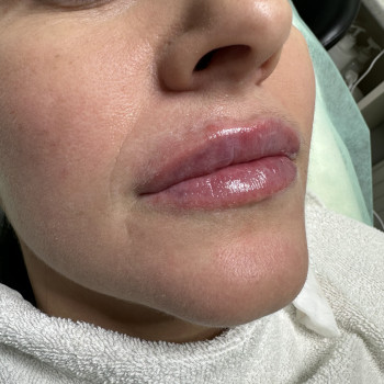 Марина Попель, Черкассы Фото - 8