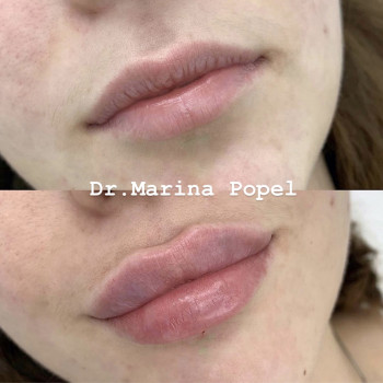 Марина Попель, Черкассы Фото - 3