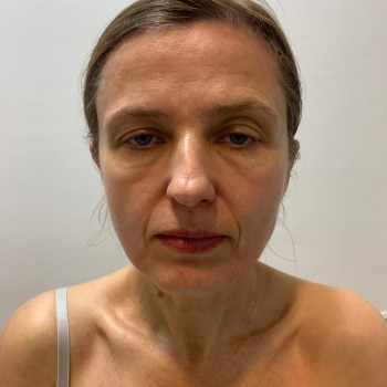 Після четвертого