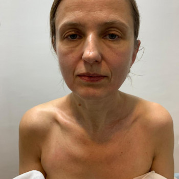 Після першого масажа