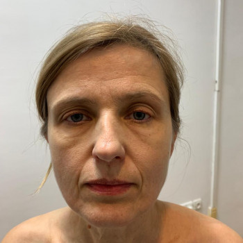 До масажа перший візит