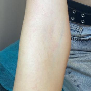  #рукидепиляция