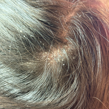 Анастасія Дягілєва, Софиевская Борщаговка Фото - 7