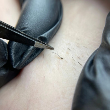 Анна Бєспалова, Сумы Фото - 7