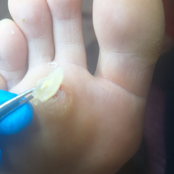 Анжела Кротенко, Кропивницький Фото - 3