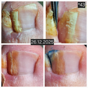 Анжела Кротенко, Кропивницький Фото - 2