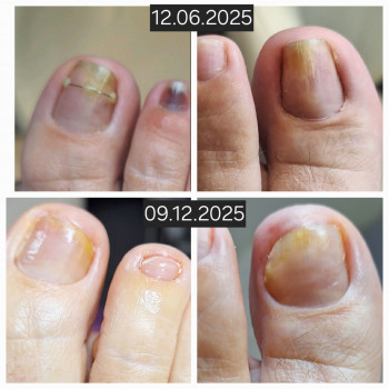 Анжела Кротенко, Кропивницький Фото - 1