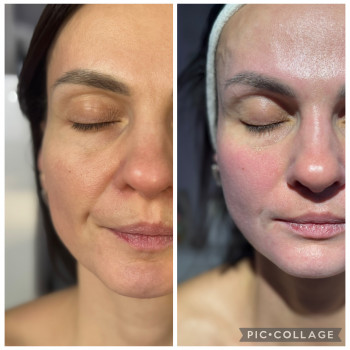 Божена Дорощук, Ровно Фото - 1